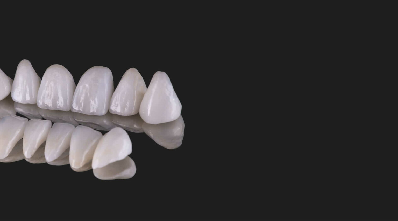Porcelain Dental Veneers Central London W1, UK Harley Street Dental